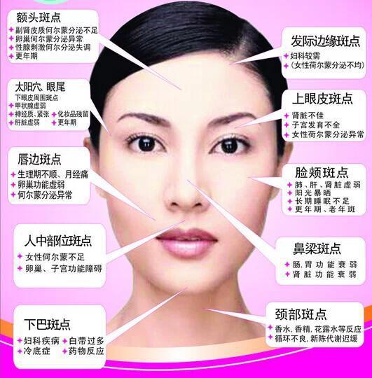 女性有五个时期是最容易长斑 牢记祛斑生活小常识 让