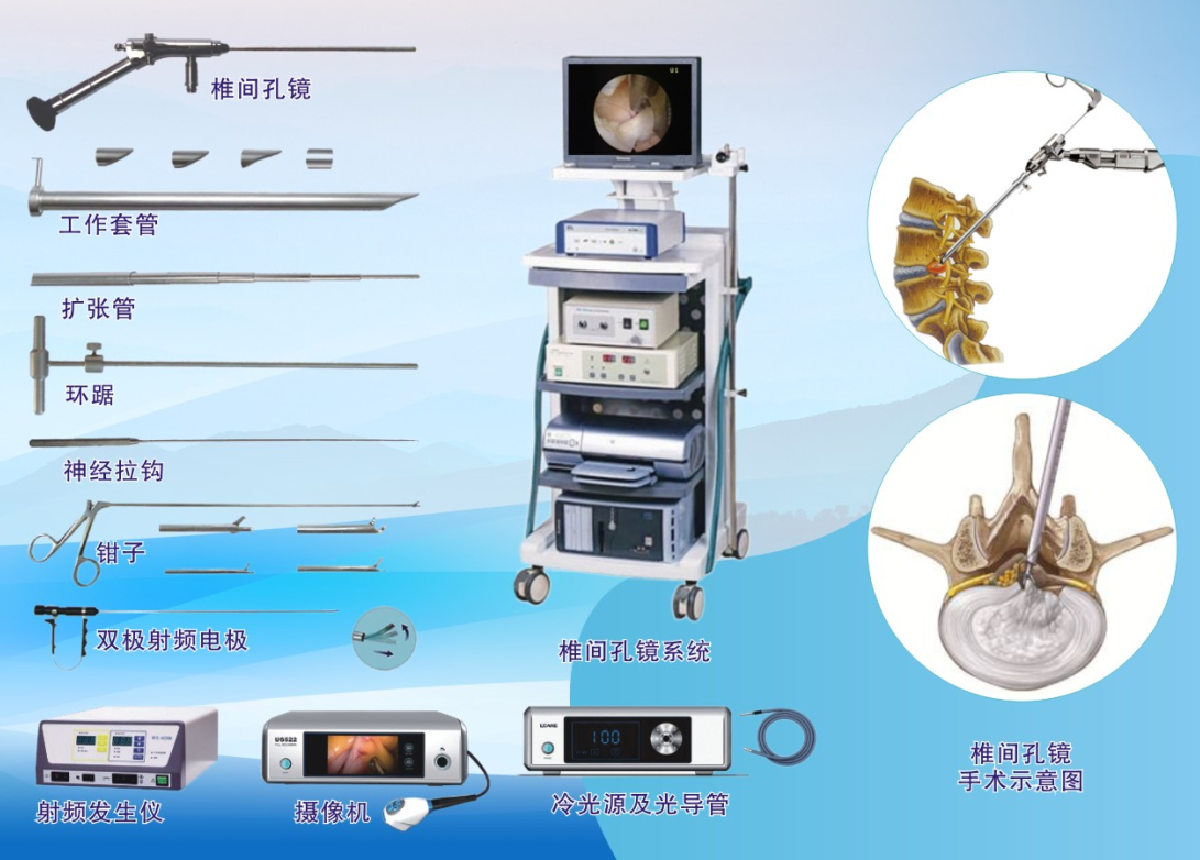 腰椎器械名称图片