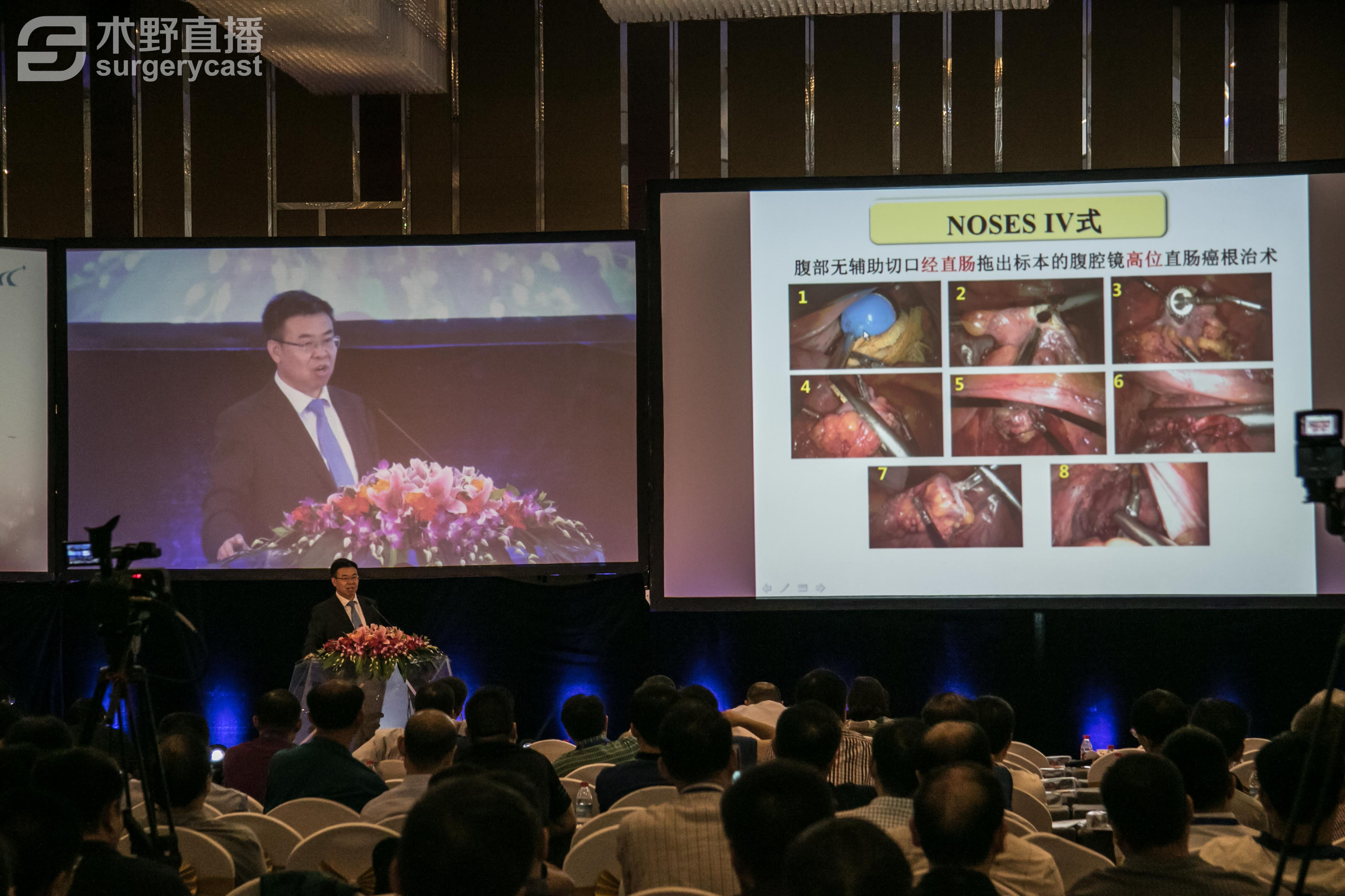 中国结直肠肿瘤noses学术会议暨3d腹腔镜手术演示会在北京成功召开