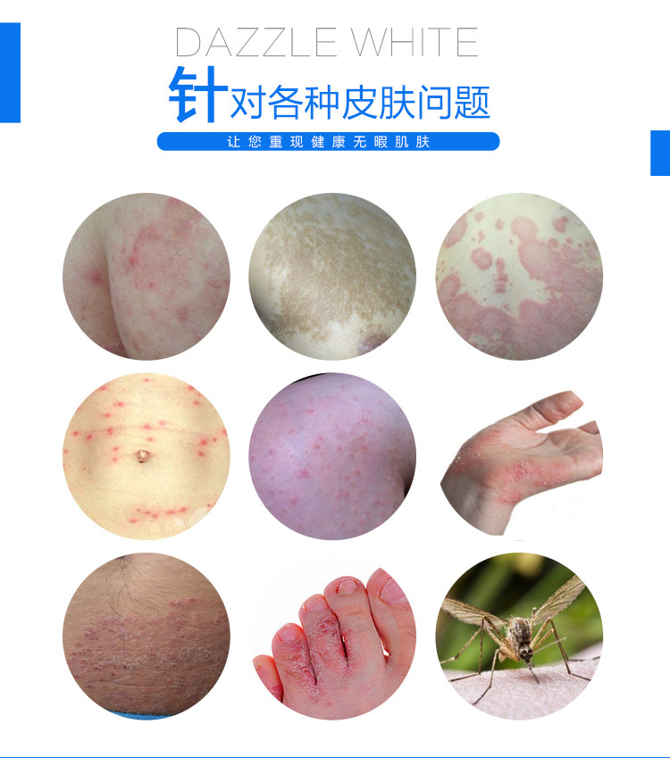 (苗域家族)苗方癣必净20g/盒