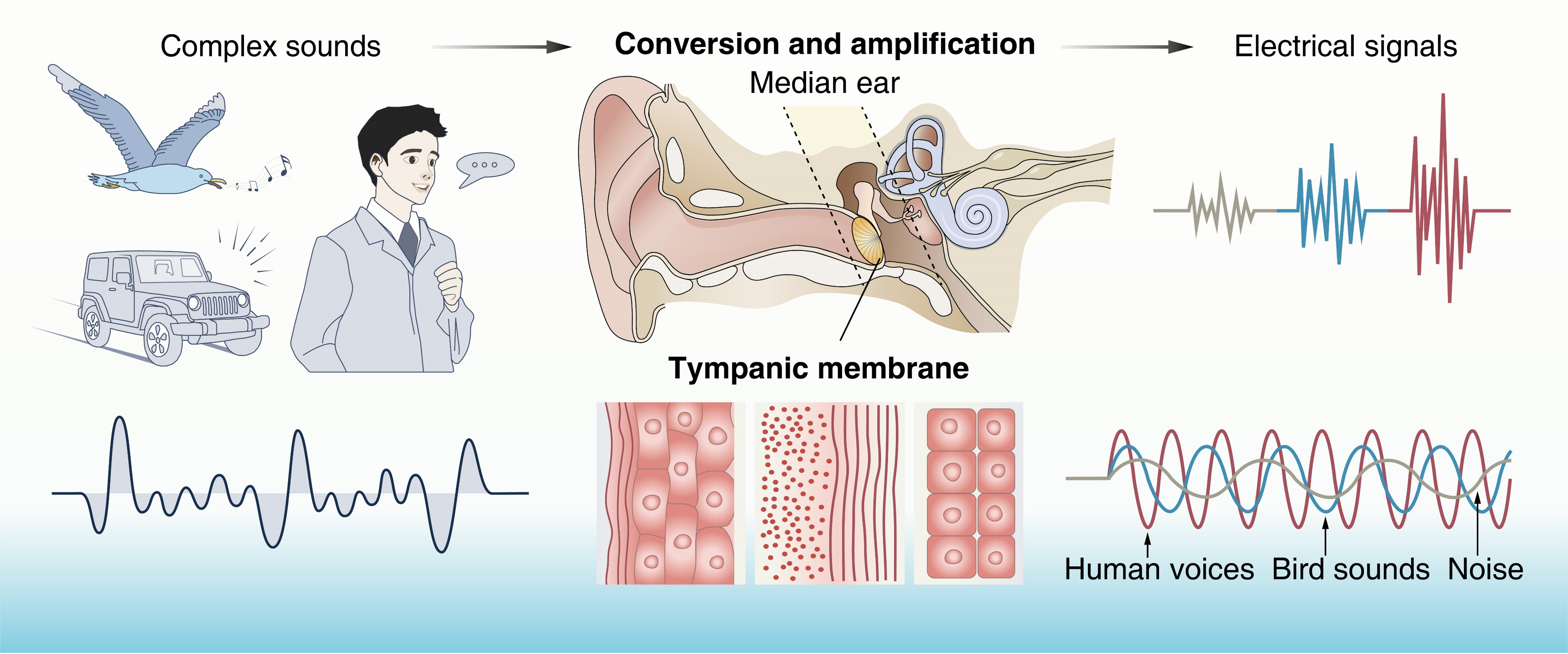 双重降噪的人工鼓膜